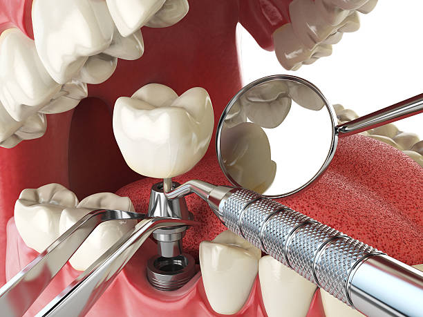 Best Same-Day Emergency Dentist in Glenrock, WY